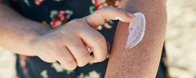 Image of a person applying sunscreen to their freckled arm. Image of a person applying sunscreen to their freckled arm.