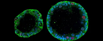 Human-Relevant In Vitro Models Enable Predictive Drug Discovery