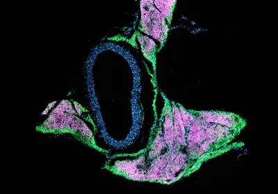 A mouse aorta with immunofluorescence tagging of various molecules, emphasizing the close connection between vasculature and fat.