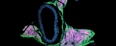 A mouse aorta with immunofluorescence tagging of various molecules, emphasizing the close connection between vasculature and fat.