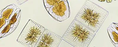 Diatoms under the microscope appear golden-yellow enclosed in glass-like walls.