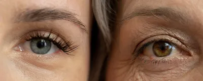Half of a young woman’s face is shown on the left, and half of an older woman’s face is on the right, representing aging.