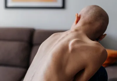 A patient with cancer sits in the living room, shirtless and facing away from the camera. They seem very thin, likely struggling with cachexia or wasting syndrome.