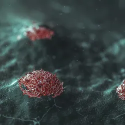 Breast cancer tumors are shown in red against a blue-colored tissue.