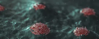 Breast cancer tumors are shown in red against a blue-colored tissue.