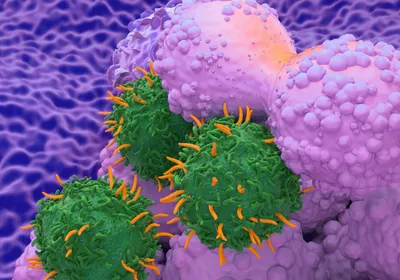 CAR T cells attacking a tumor