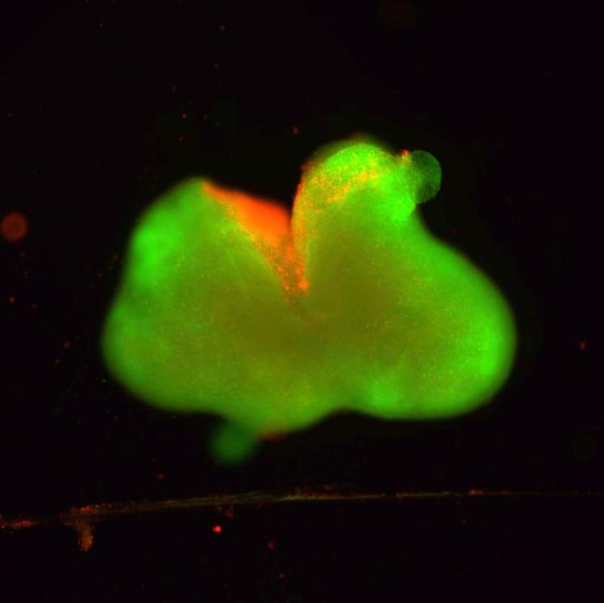 A green blob with some red areas, signifying cell death in spinal cord organoids, against a black background.