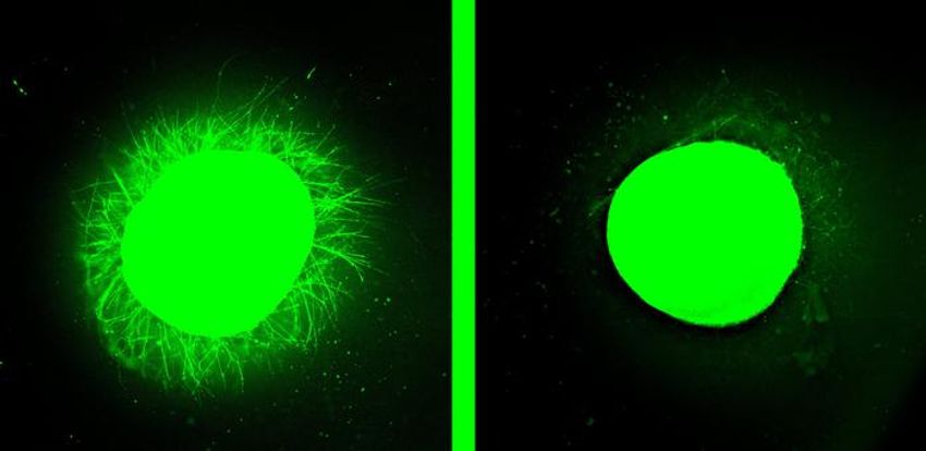 Two green circles against a black background, signifying spinal cord organoids. The one on the right has several projections, while the one on the right has fewer.