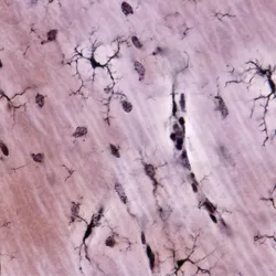 A microscope image of the brain’s immune cells called microglia are shown. A single-cell spatial proteomic atlas helped clarify the cells’ role in Alzheimer’s disease.