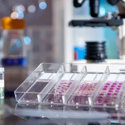 Histological slides with stained patient samples are displayed in a clear holder on the right, and other patient tissue samples are held in clear bottles on the left.