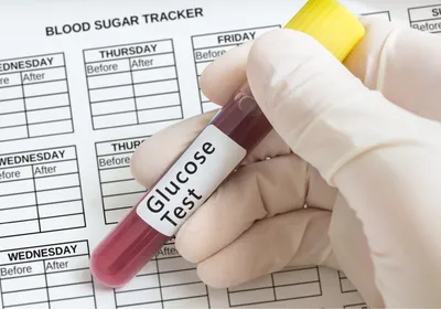 A gloved hand holds test tube with blood for glucose test to recognize diabetes.