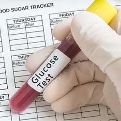 A gloved hand holds test tube with blood for glucose test to recognize diabetes.