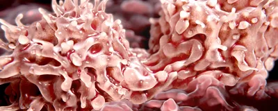 Predicting Chemotherapy Response with Patient-Derived Gastric Cancer Organoids