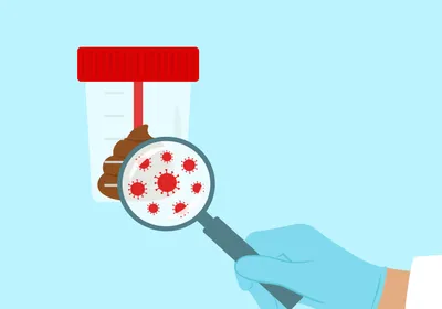 Illustration of a gloved hand holding a magnifying glass to examine stool sample in laboratory container. The magnifying glass shows a close-up view of virus cells in the stool.
