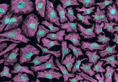 HeLa cells are stained purple and blue against a black background.