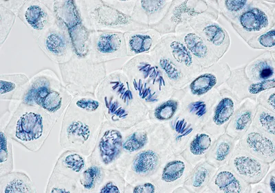Microscope image of plant cells splitting DNA during cell division.