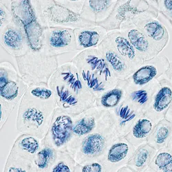 Microscope image of plant cells splitting DNA during cell division.