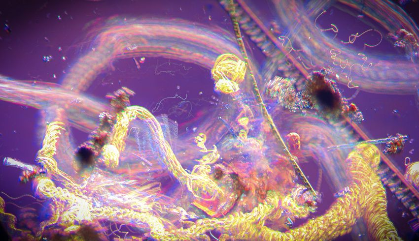 Image of golden algae colonies in the foreground as larger rotifers streak past in pale arcs alongside filamentous algae in the background.