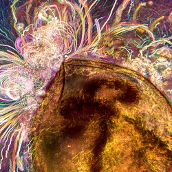 Image of a water flea with attached vorticella. A fireworks-like trail of cells bursts from it.