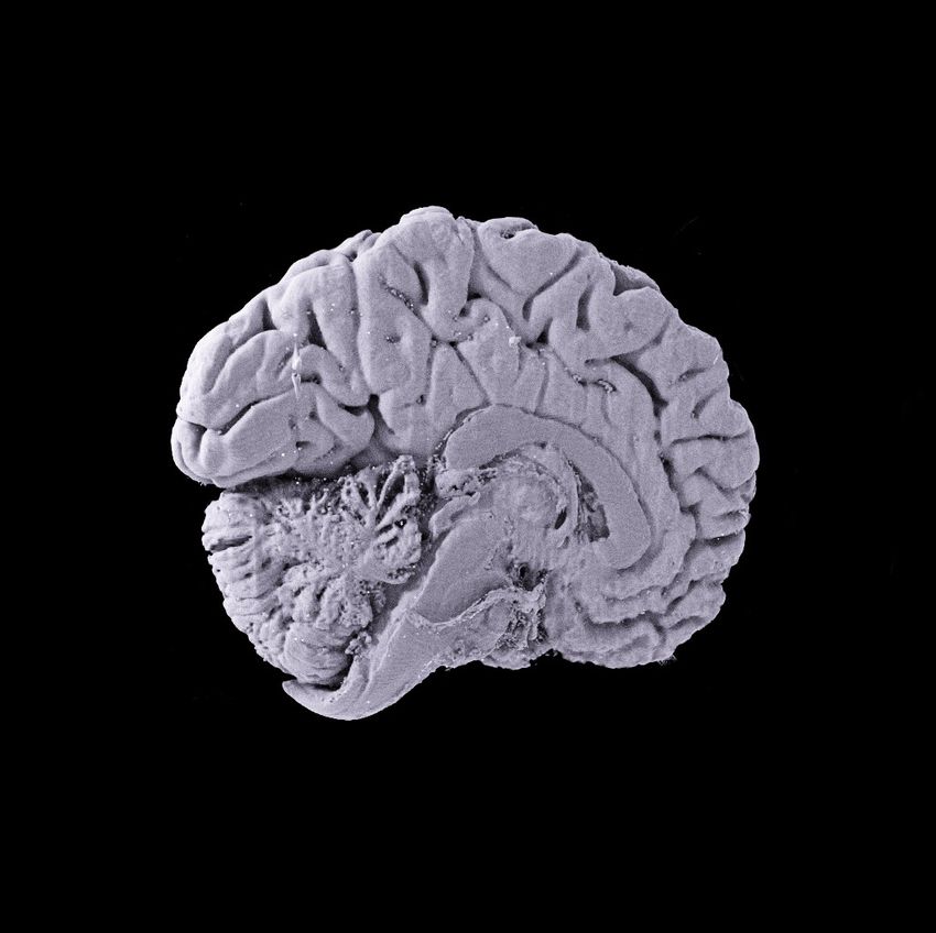 Image of a brain in the Human Organ Atlas.