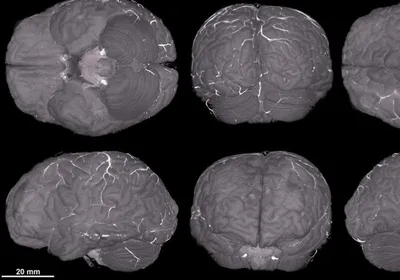 Brain images at various angles displayed in the Human Organ Atlas.