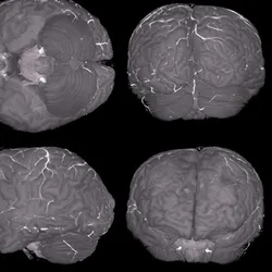 Brain images at various angles displayed in the Human Organ Atlas.