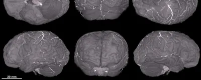 Brain images at various angles displayed in the Human Organ Atlas.