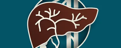 Image of a liver outline with white outlines of the gallbladder, ducts, and veins behind the liver.