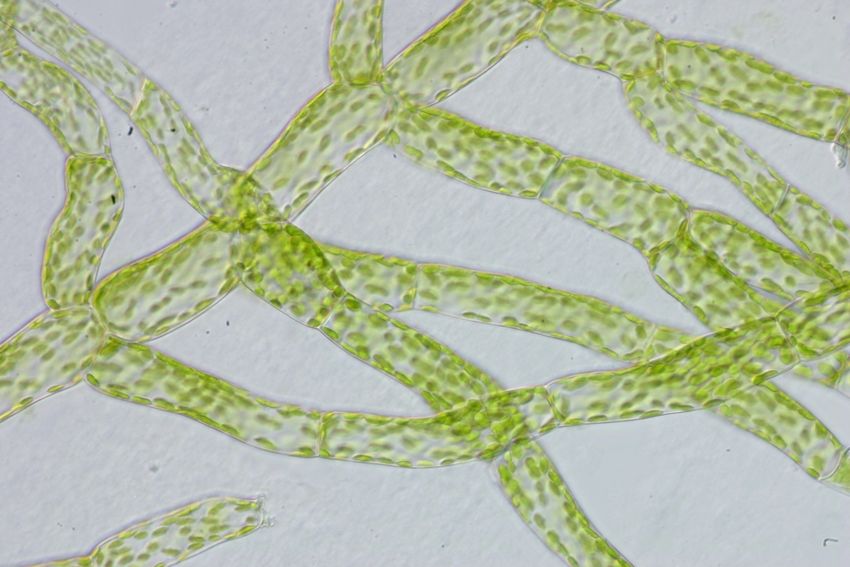 Long threads of moss protonema, showing green chloroplasts, on a clear background.