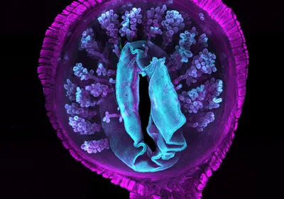 A microscopy image of the mouse uterine tissue against a black background. The tissue appears round, with empty space in the center surrounded by cyan-colored cells which give way to spherical cyan and magenta structures. This is surrounded by a magenta circle.