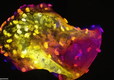 Combined image of all sections through a neurobot, showing multiciliated cells on the surface and neurons in the center.