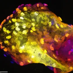 Combined image of all sections through a neurobot, showing multiciliated cells on the surface and neurons in the center.