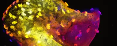 Combined image of all sections through a neurobot, showing multiciliated cells on the surface and neurons in the center.