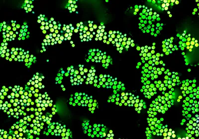 Graphic showing glowing green Cryptococcus fungi