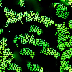 Graphic showing glowing green Cryptococcus fungi