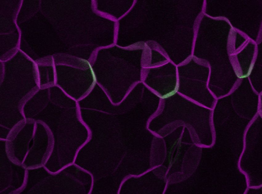 A microscopy image that shows cells (magenta) and the expression of a protein (green). A microscopy image that shows cells (magenta) and the expression of a protein (green).