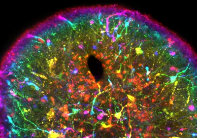 A multi-colored image of a midbrain organoid is shown on a black background.
