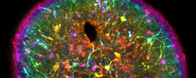A multi-colored image of a midbrain organoid is shown on a black background.
