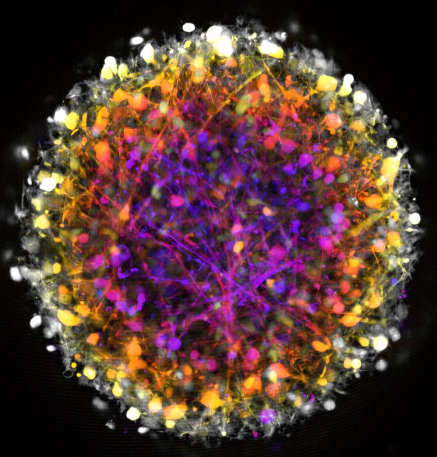 A multi-colored image of a midbrain organoid is shown on a black background.