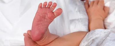 A newborn’s feet, with a band aid on the heel of one foot.   