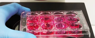 A scientist using a microscope to monitor 2D cell cultures