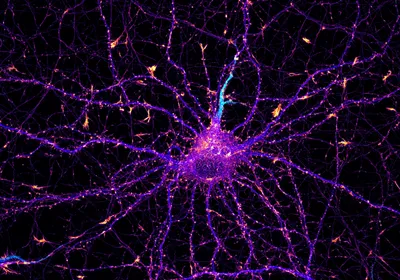Microscopic image of a neuron with pink, blue, and cyan cells on a black background. 