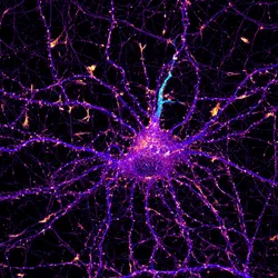 Microscopic image of a neuron with pink, blue, and cyan cells on a black background. 