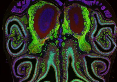 Fluorescent microscopy image of the inside of a mouse’s nose. Smell receptors are labeled with green fluorescent protein and are dotted throughout the scroll-like anatomy of the organ. At the edges, cells labeled in red represent dying neurons.