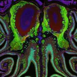 Fluorescent microscopy image of the inside of a mouse’s nose. Smell receptors are labeled with green fluorescent protein and are dotted throughout the scroll-like anatomy of the organ. At the edges, cells labeled in red represent dying neurons.