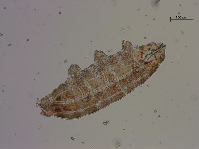 Picture of a tardigrade with a 100 micrometer scale at the bottom left corner for reference.