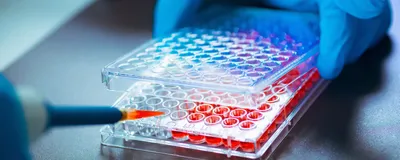 A photo of a scientist adding cell culture medium to a 96-well microplate using a pipette.
