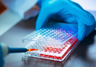 A photo of a scientist adding cell culture medium to a 96-well microplate using a pipette.