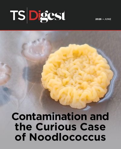 Image of a bright yellow noodle-like bacterial colony growing on an agar plate. There are three smaller white and mucoid colonies next to it.