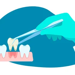 A hand wearing a green glove grabs a decaying tooth from an open mouth.
